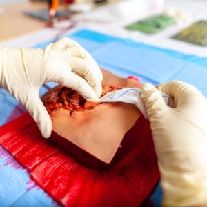 Controle de Hemorragia no APH – 8 horas